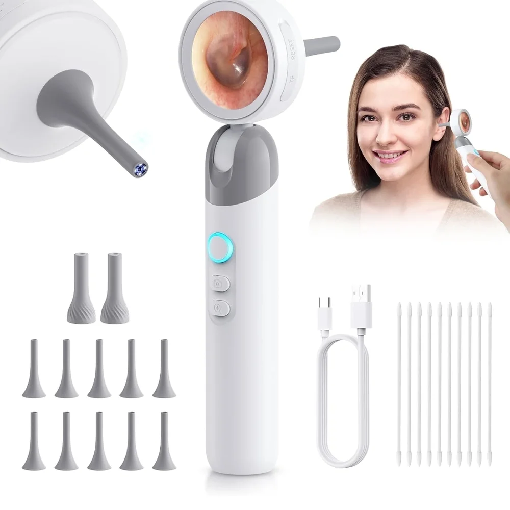 Digital Ear Camera with 3x Magnification